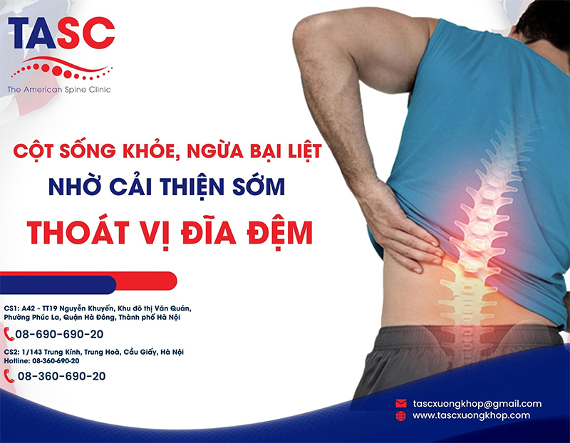 Cải thiện tình trạng thoát vị đĩa đệm nhờ phương pháp Chiropractic