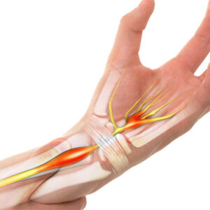 Chữa tê bì chân tay Trung Kính