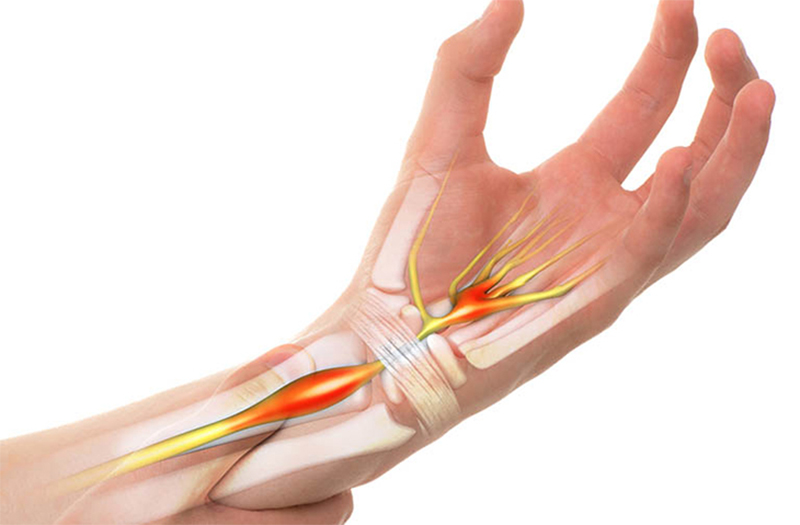 Chữa tê bì chân tay Trung Kính